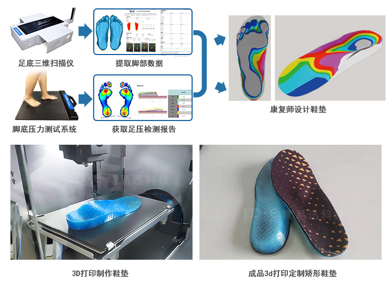 足底三維掃描儀-定制3D打印矯形鞋墊.jpg